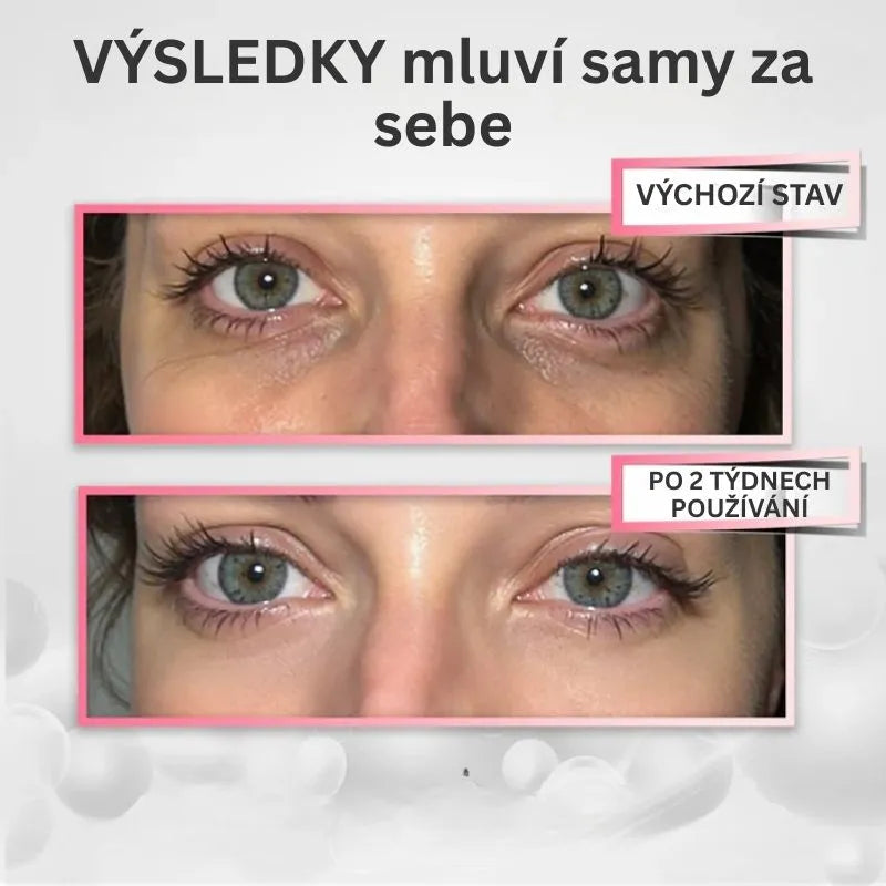 Oční LED terapie proti vráskám – YUMA RevitalEyes